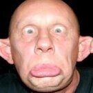 Retard.Anty.LifePoints